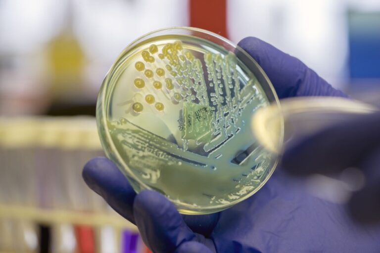 sexually transmitted disease epidemic